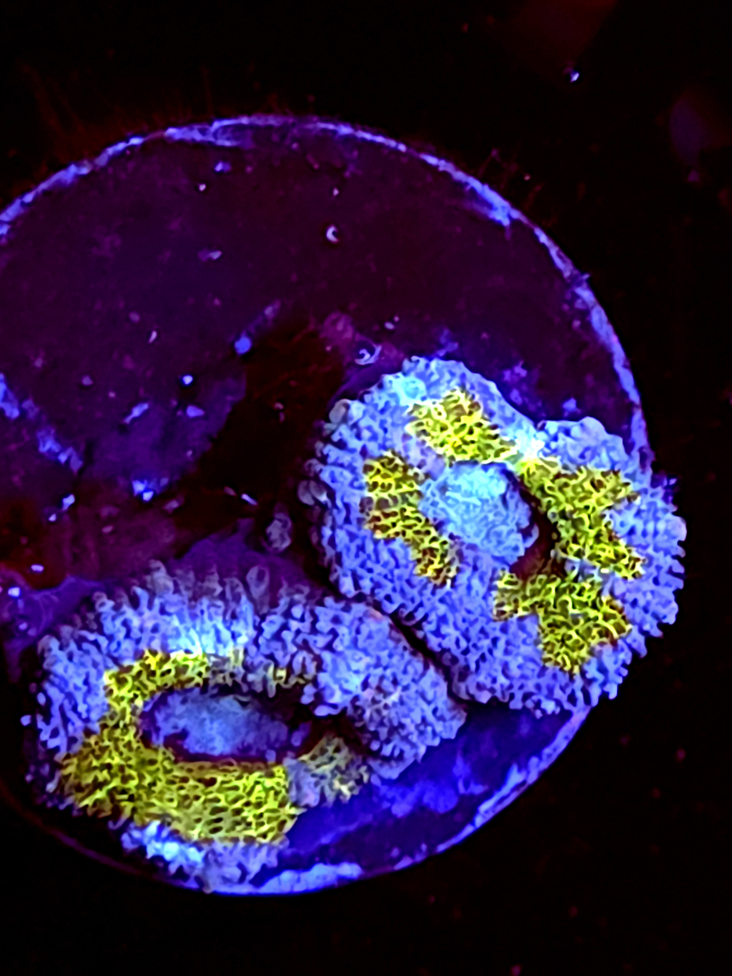 SBB "Mystery Signature" Acan 2 Heads