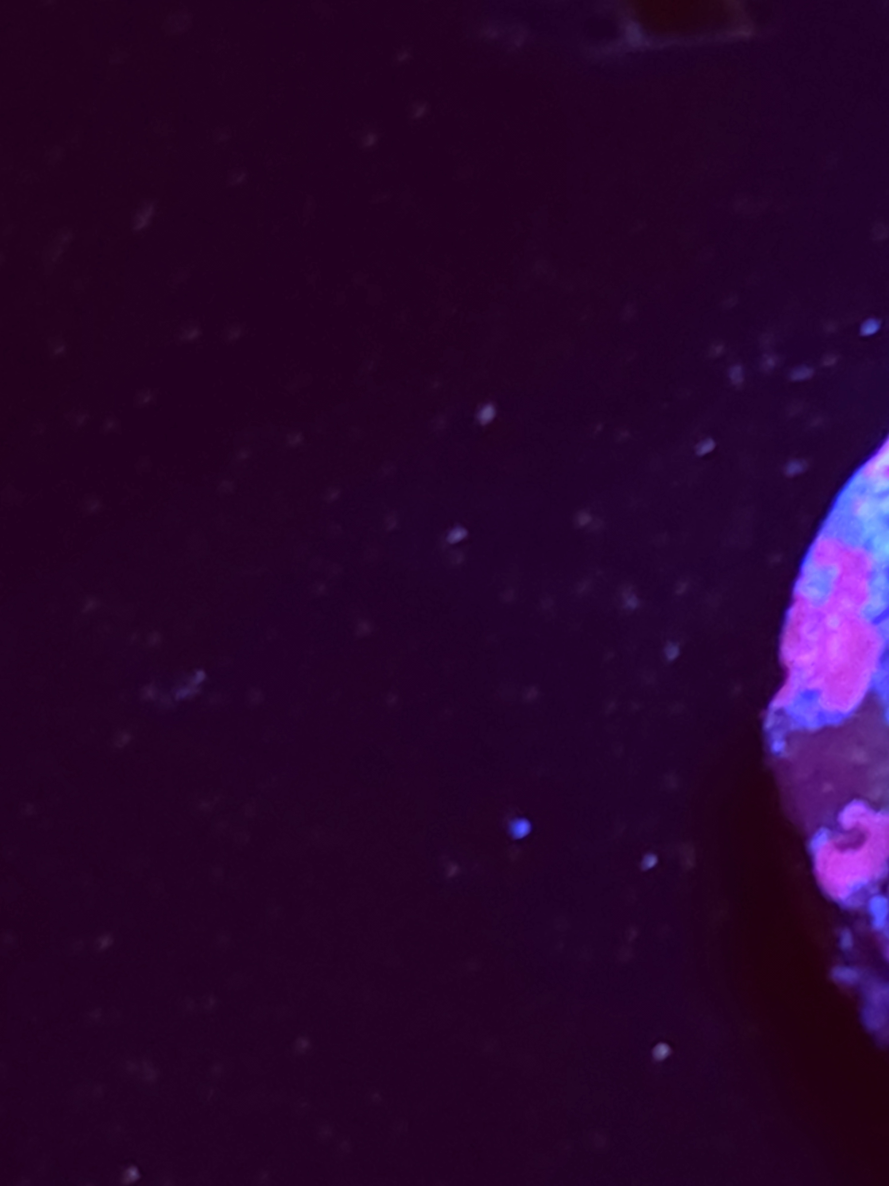 SBB "No Name" Zoas 5 Polyps